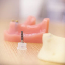 Zahnarzt Dr. Hamid Shirazi in Weiterstadt | Wir machen mehr aus Ihrem Lächeln